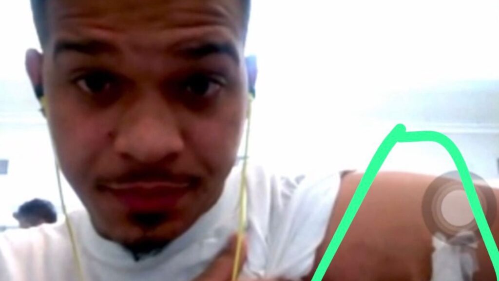 Dominicano que se fue por México denuncia es usado para prácticas de cirugías